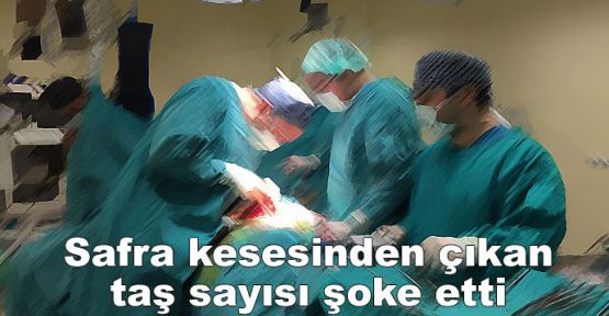 Safra kesesinden çıkan taş sayısı doktorları bile şoke etti