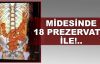  Midesinde 18 prezervatif ile!..